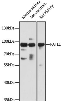 PATL1 Rabbit pAb