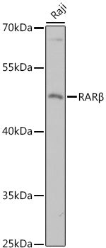 RARβ Rabbit pAb