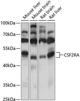 CSF2RA Rabbit pAb