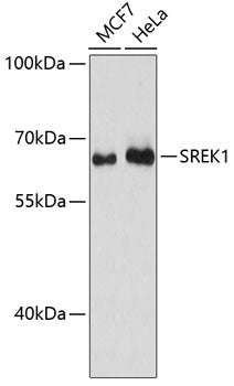 SREK1 Rabbit pAb