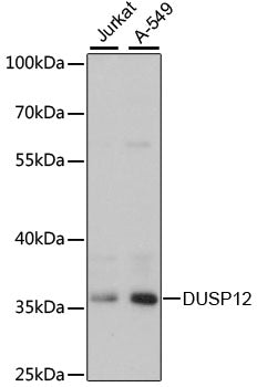 DUSP12 Rabbit pAb