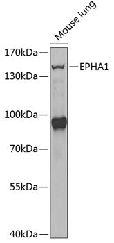 EPHA1 Rabbit pAb
