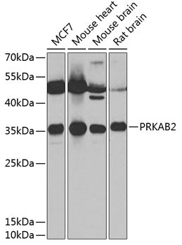 PRKAB2 Rabbit pAb