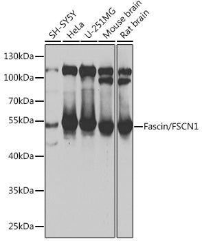 Fascin/FSCN1 Rabbit pAb