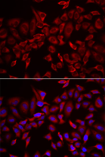 CSRP3 Rabbit pAb