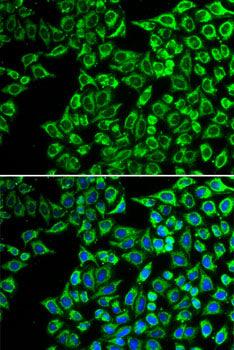LIPC Rabbit pAb