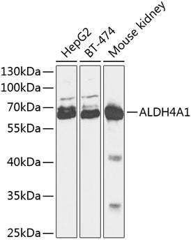 ALDH4A1 Rabbit pAb
