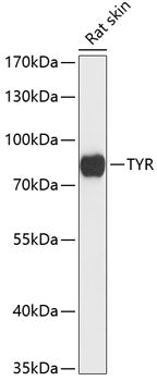 Tyrosinase Rabbit pAb