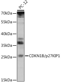 CDKN1B/p27KIP1 Rabbit pAb