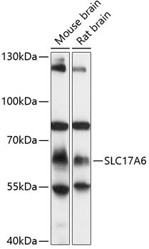 SLC17A6 Rabbit pAb