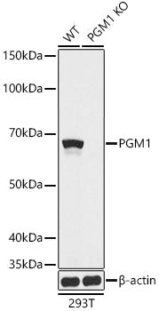 [KO Validated] PGM1 Rabbit pAb