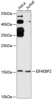 EIF4EBP2 Rabbit pAb