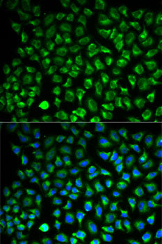 Monoamine Oxidase A (MAOA) Rabbit pAb