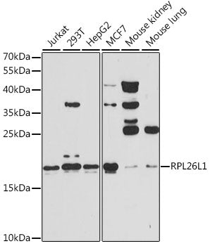 RPL26L1 Rabbit pAb