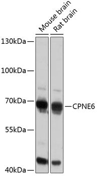 CPNE6 Rabbit pAb