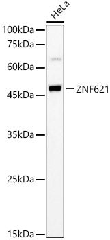 ZNF621 Rabbit pAb