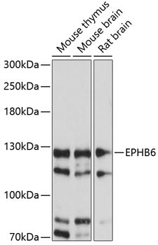 EPHB6 Rabbit pAb