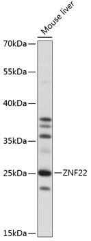 ZNF22 Rabbit pAb