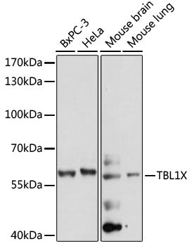 TBL1X Rabbit pAb