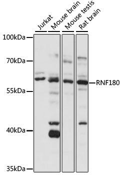RNF180 Rabbit pAb