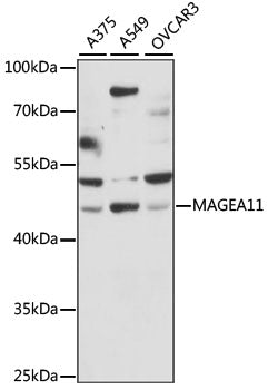 MAGEA11 Rabbit pAb