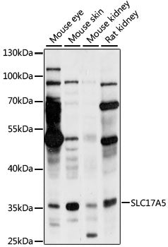 SLC17A5 Rabbit pAb