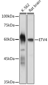 ETV4 Rabbit pAb