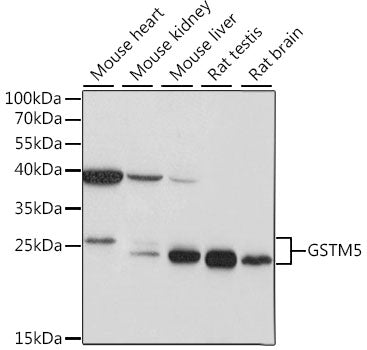 GSTM5 Rabbit pAb