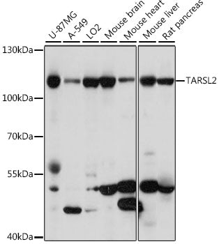 TARSL2 Rabbit pAb