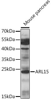ARL15 Rabbit pAb