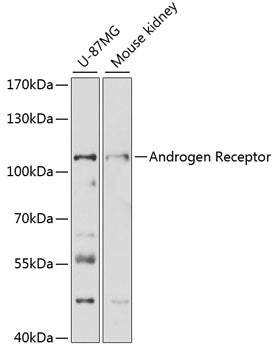 Androgen Receptor Rabbit pAb