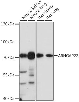 ARHGAP22 Rabbit pAb