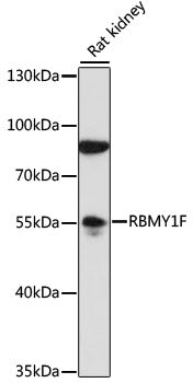 RBMY1F Rabbit pAb