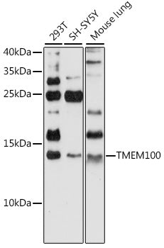 TMEM100 Rabbit pAb