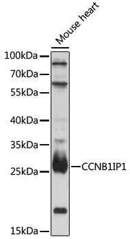 CCNB1IP1 Rabbit pAb