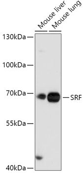SRF Rabbit pAb