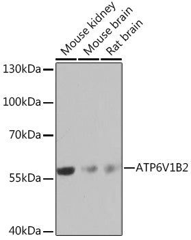 ATP6V1B2 Rabbit pAb