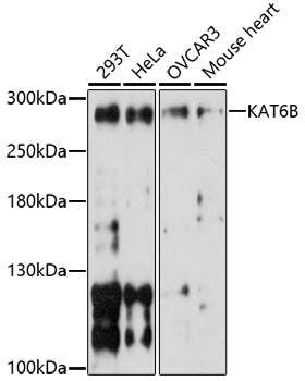 KAT6B Rabbit pAb