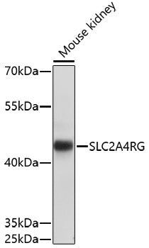 SLC2A4RG Rabbit pAb