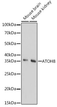 ATOH8 Rabbit pAb