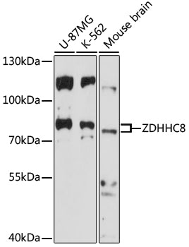 ZDHHC8 Rabbit pAb