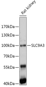 SLC9A3 Rabbit pAb
