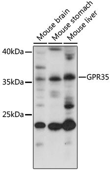 GPR35 Rabbit pAb