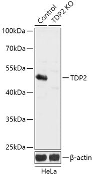 [KO Validated] TDP2 Rabbit pAb