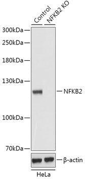 [KO Validated] NF-κB2 Rabbit pAb