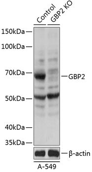 [KO Validated] GBP2 Rabbit pAb
