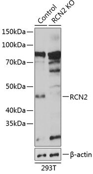 [KO Validated] RCN2 Rabbit pAb