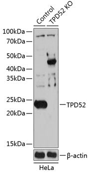 [KO Validated] TPD52 Rabbit pAb