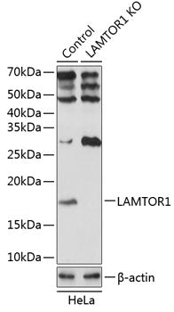 [KO Validated] LAMTOR1 Rabbit pAb