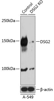 [KO Validated] DSG2 Rabbit pAb